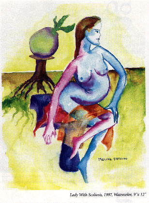 Painting  -Lady with Scoliosis- by Melina